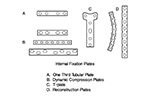 Drawing of fracture fixation plates